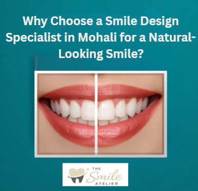 Smile Design Specialist in Mohali